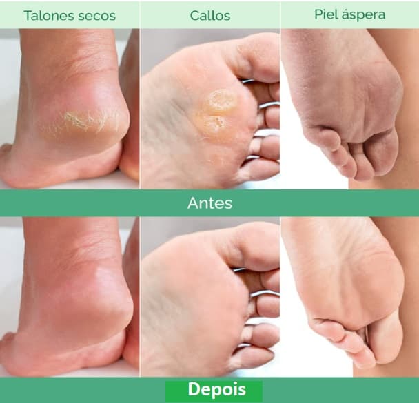 💥 TRENDING: Exfoliating Foot Mask Dermatologically Tested - 2