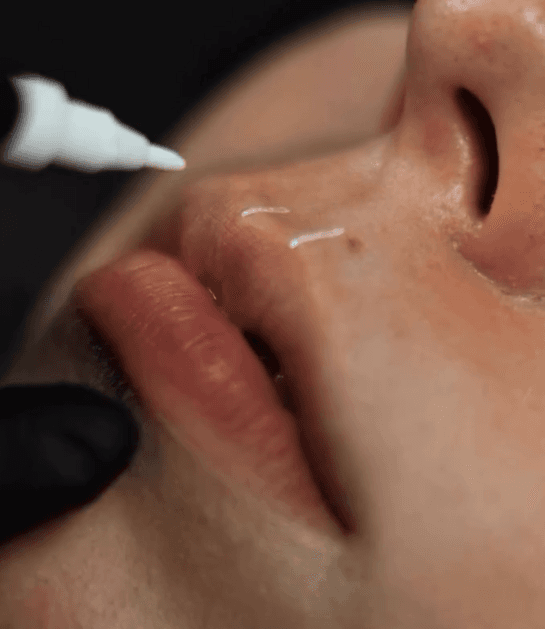 White Skin Marker | Professioneller Marker - AS Company - 4