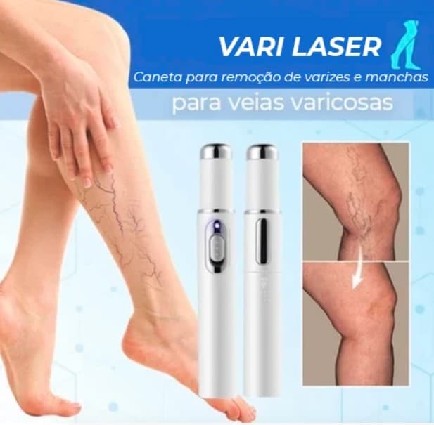 Vari Care - Bolígrafo para la eliminación de varices, manchas y acné - 3
