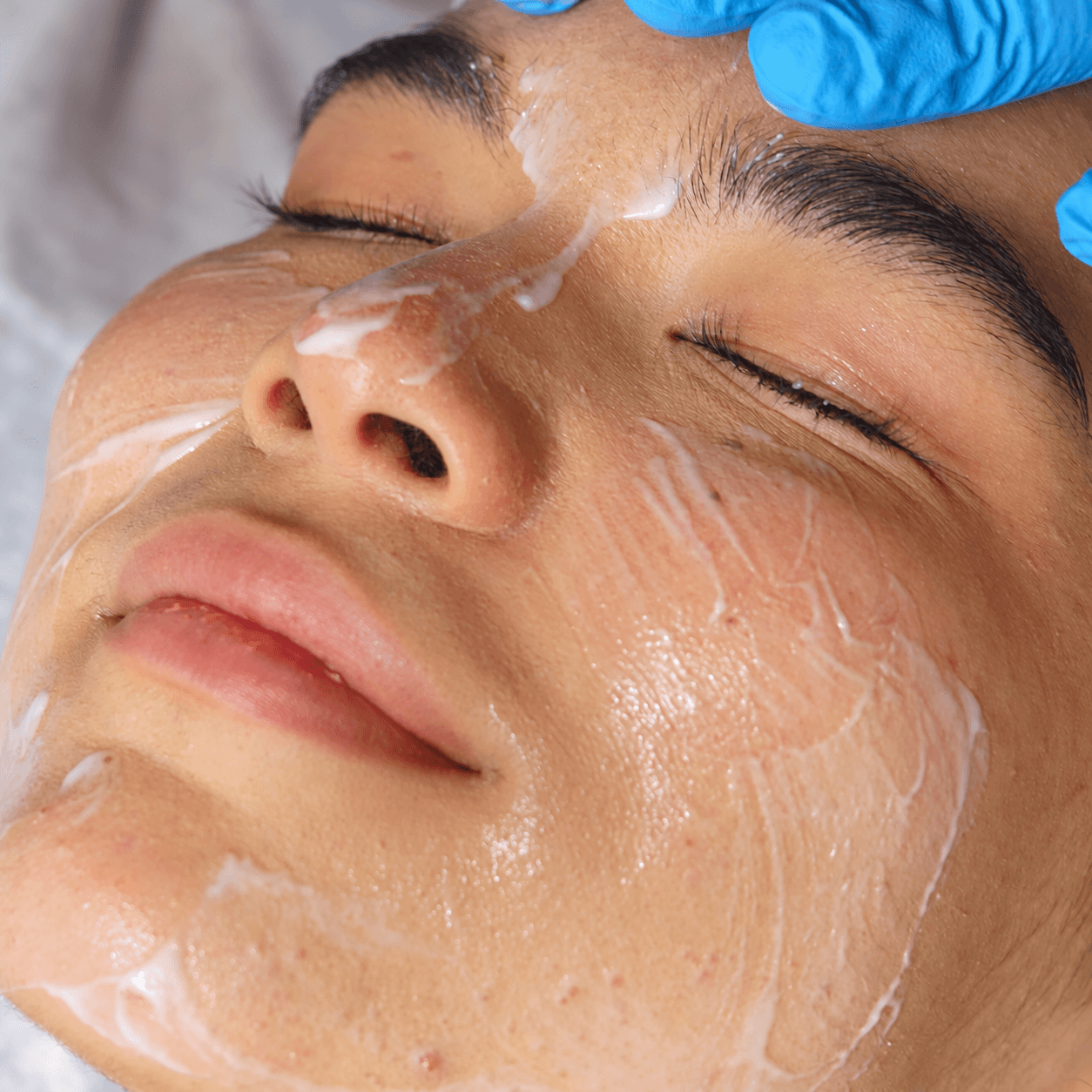 Aplicación profesional de Prisma Peeling Smart GR, mostrando la textura del producto sobre el rostro