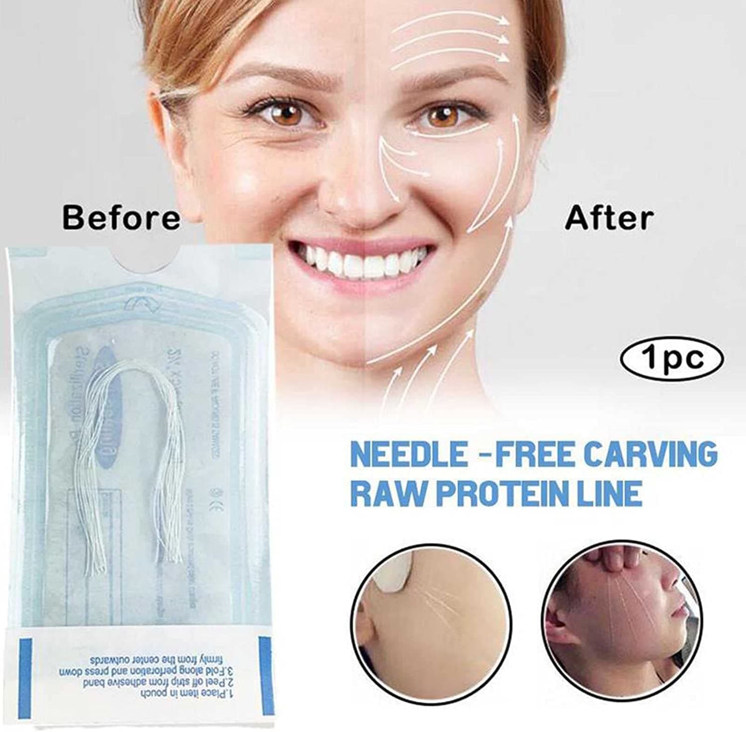 Silk Collagen Threads 240 Units - 2